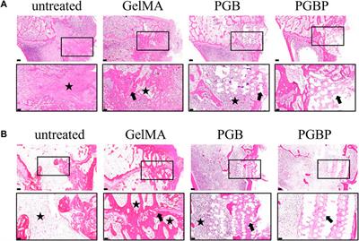 3D bioprinted hydrogel/polymer scaffold with factor delivery and mechanical support for growth plate injury repair